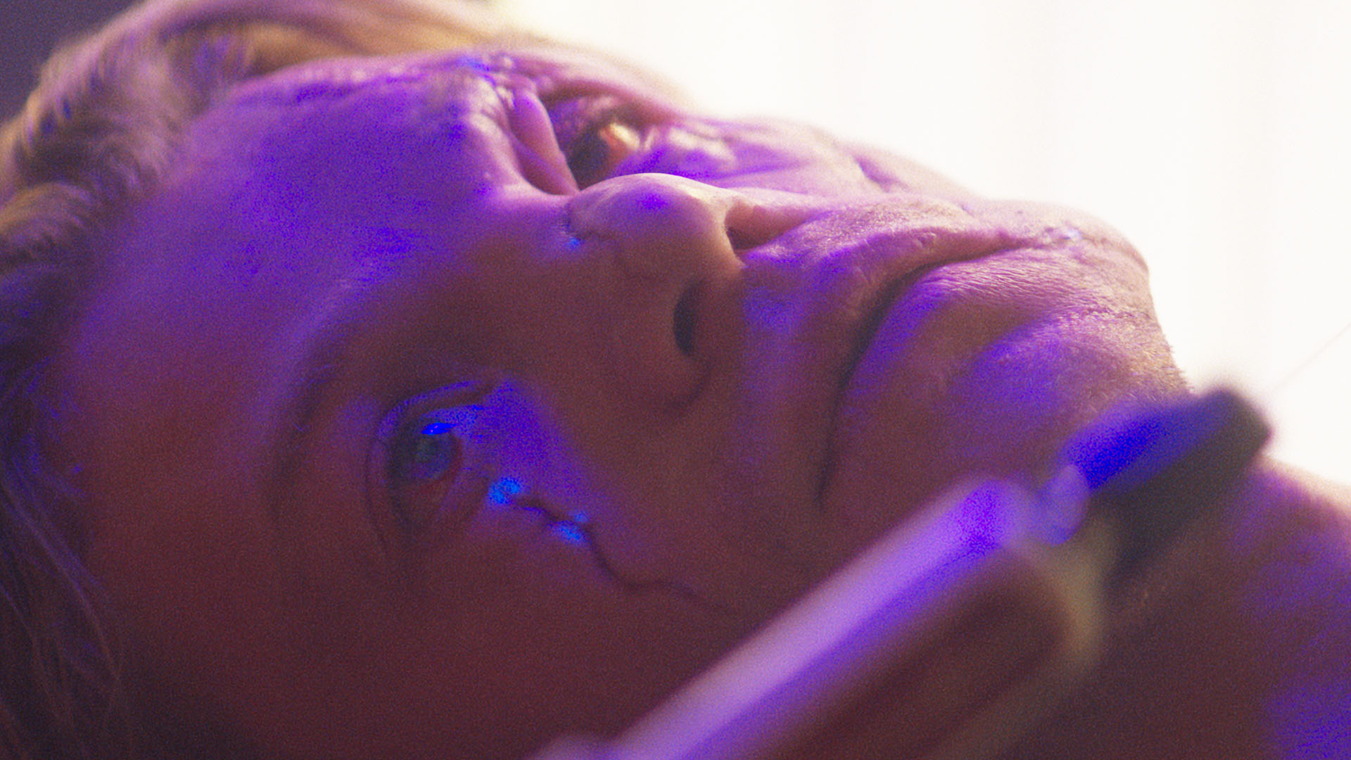 A close up of Matt Hagen's heavily scarred face looking at someone holding a giant needle in Clayface